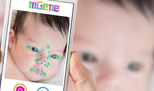 Yapay Zekâ, Nadir Hastalıklarla Mücadeleyi Yeniden Şekillendiriyor
