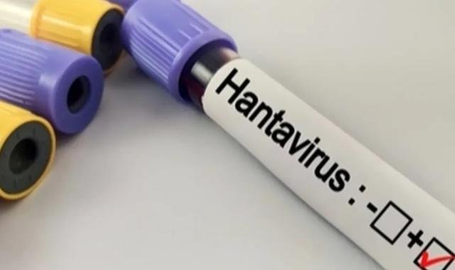 Hantavirüs salgına dönüşür mü?