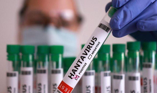 Hantavirüs açıklaması: Türkiye'de pozitif vaka yok!