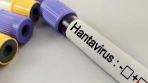 Hantavirüs salgına dönüşür mü? Kapalı alan temizliğinde büyük risk