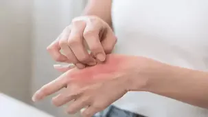 Kaşıntı cilt sorunu değil, psikolojik etkenler var